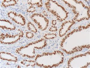 3780B | Control Slides:Immunopathology;Thyroid Transcription Factor (TTF-1)